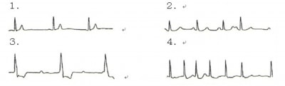 心電図の異常