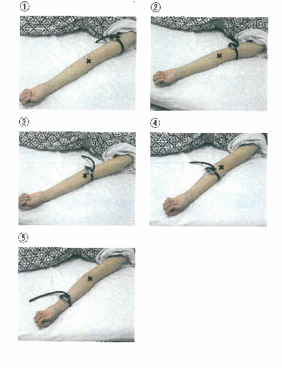 肘正中皮静脈からの採血