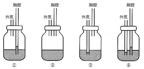 ドレナージ