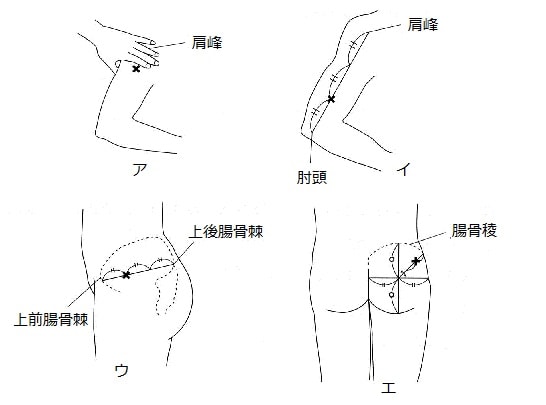 筋肉内注射を行う部位