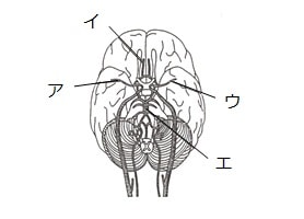 脳梗塞患者